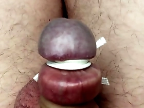 Stretched foreskin and tied glands.